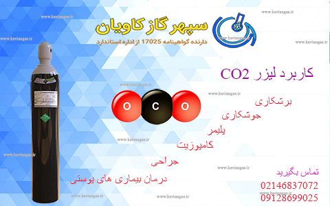 CO2 موردنیاز برای لیزر را از سپهرگازکاویان تهیه کنید.